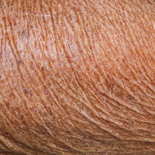 What Makes Skin Look Older?