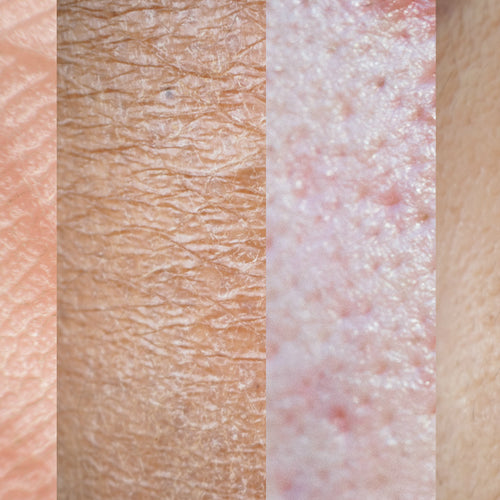 Do Skin Types Matter?